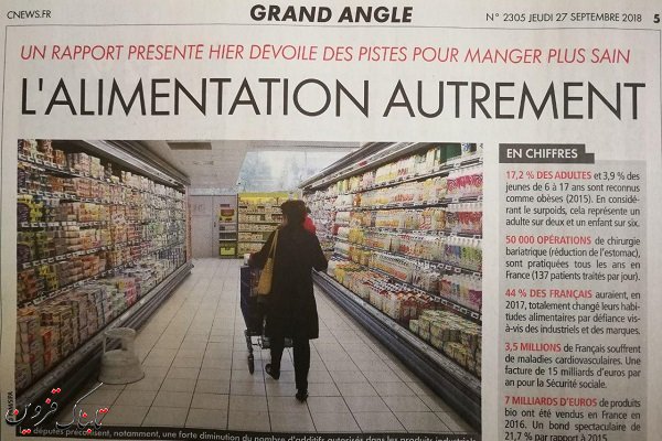 روزانه ۱۳۷ فرانسوی معده&zwnj; خودشان را کوچک می&zwnj;کنند!